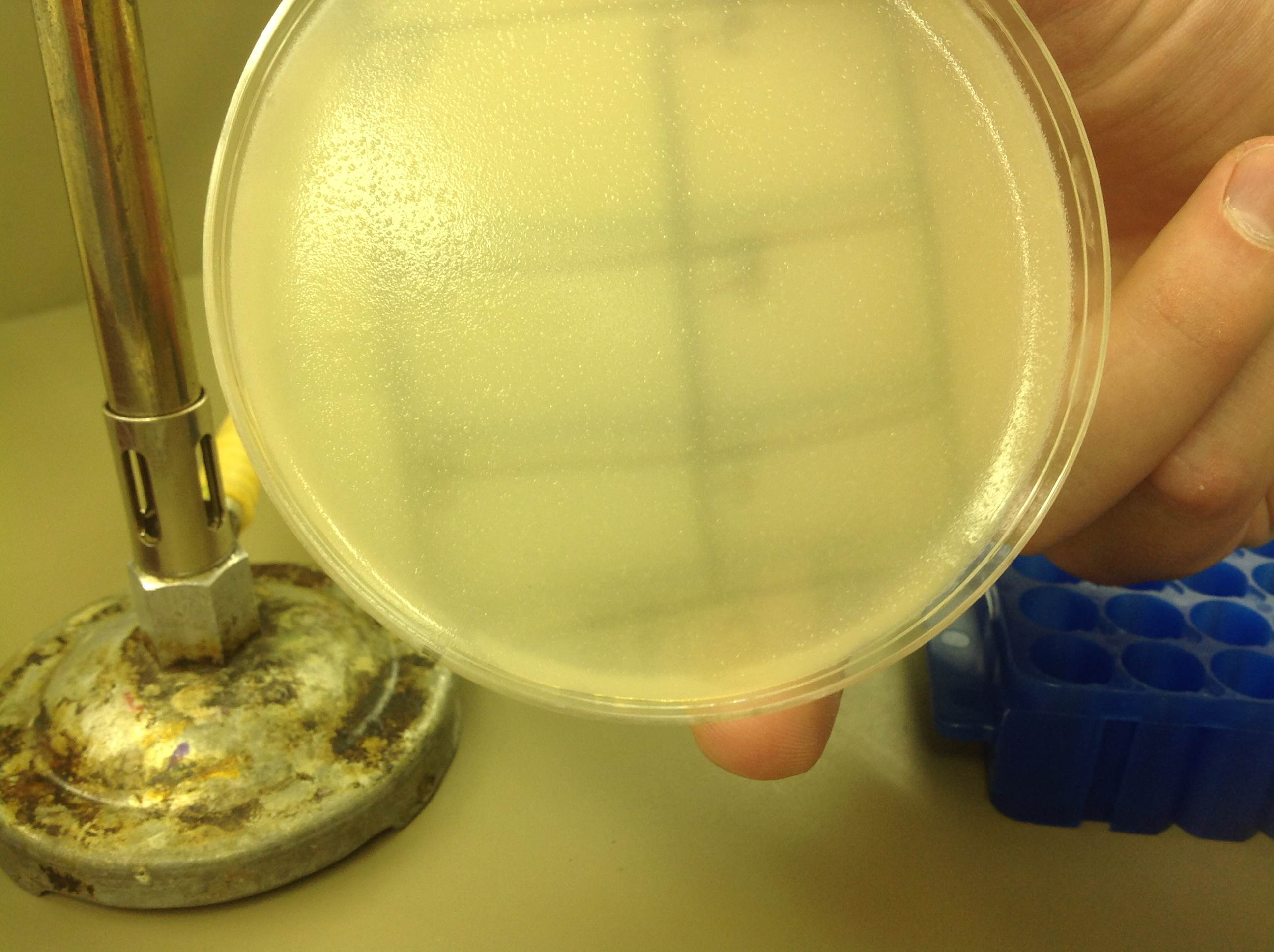 A no phage plaques were found on this sample.