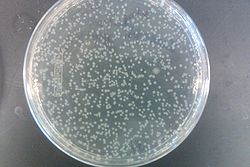 EcNR2 1 Our plasmid positive rest 7-31 Kan.jpg