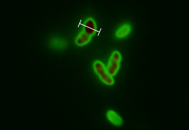 Close up of several cells, showing GFP expression in the periplasm
