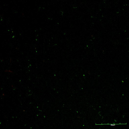 Ln12GFP&RFP.png