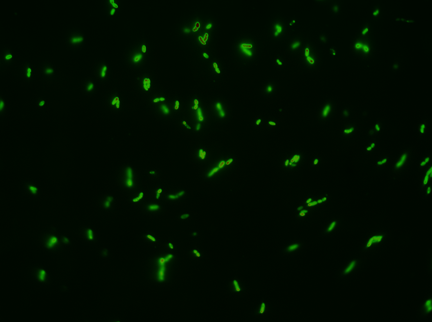 Transformed E. coli taken with a confocal microscope