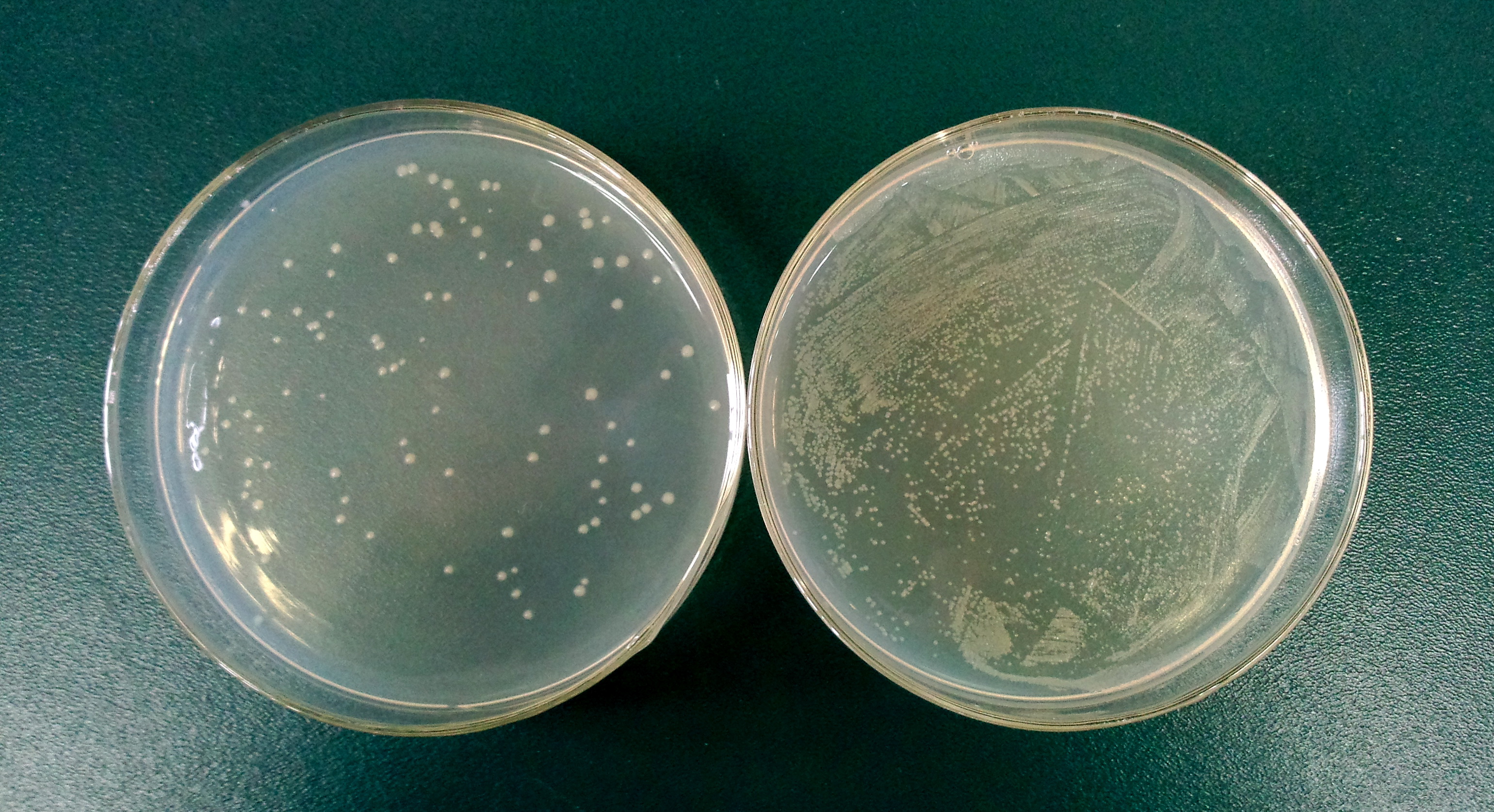 ZJU-Bacterial-Ghost-Results-5.jpg