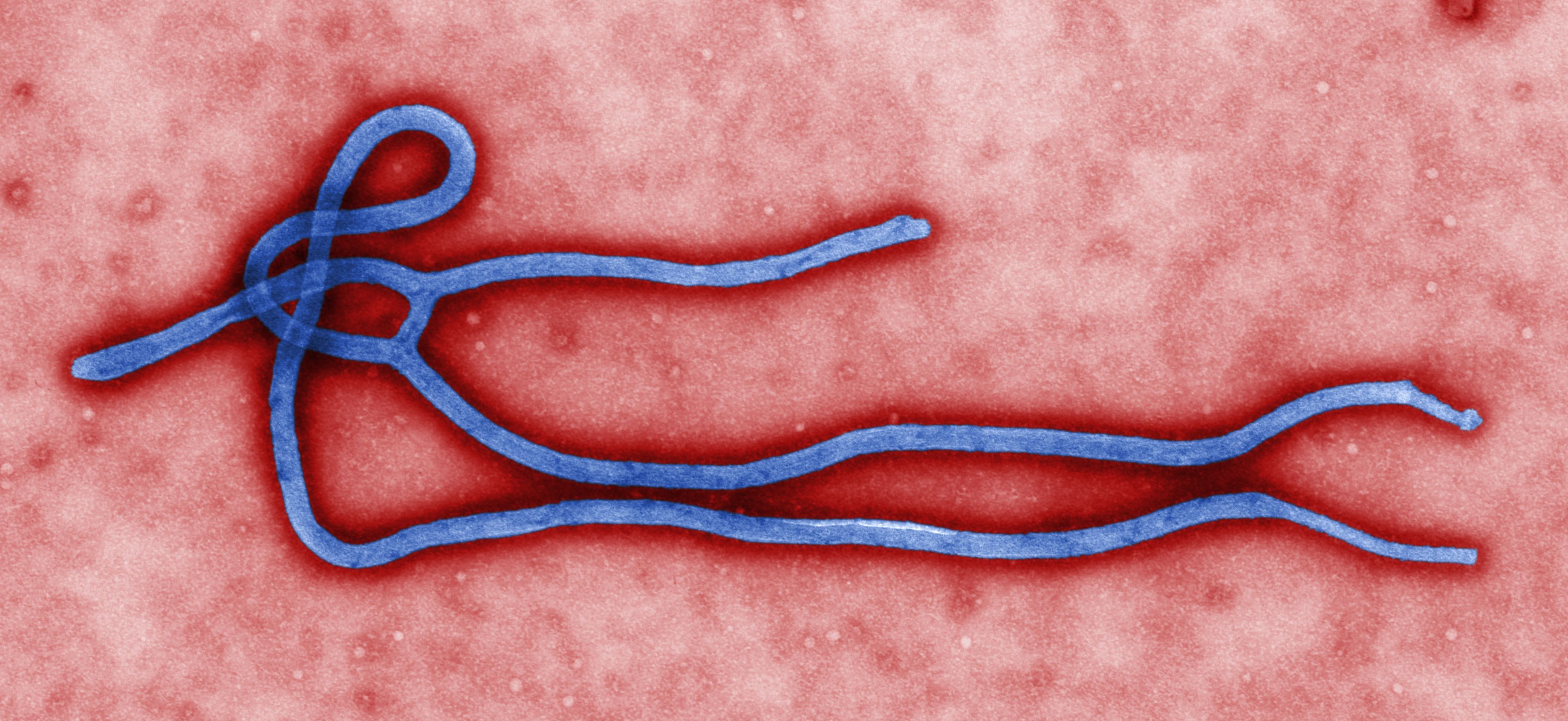 The ebola virus, one of the most dangerous virons.