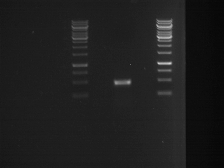 TUM13 20130610 anal gel PCR P192.png