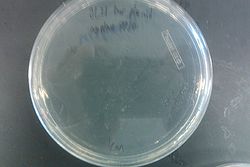 BL21 Our plasmid negative 7-31 Kan.jpg